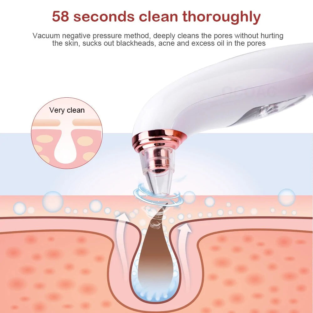PoreMaster LED Blackhead Vacuum