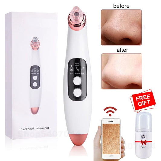 PoreMaster LED Blackhead Vacuum