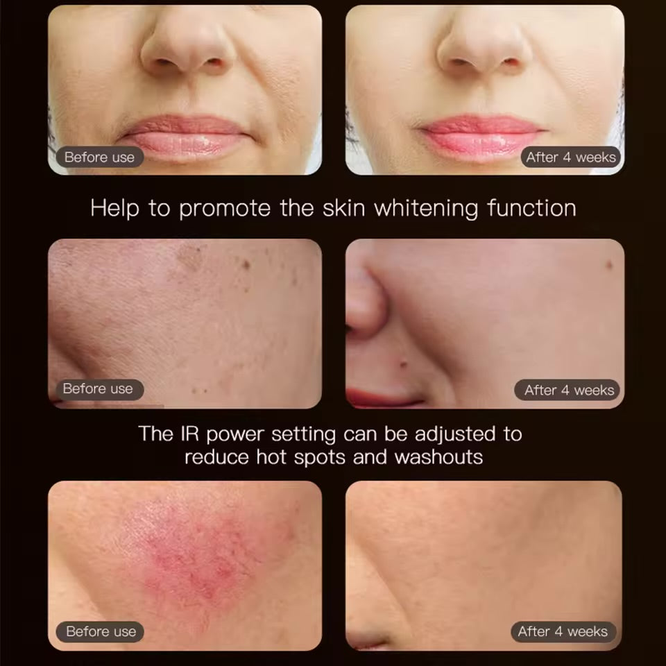 Photon Beauty Mask