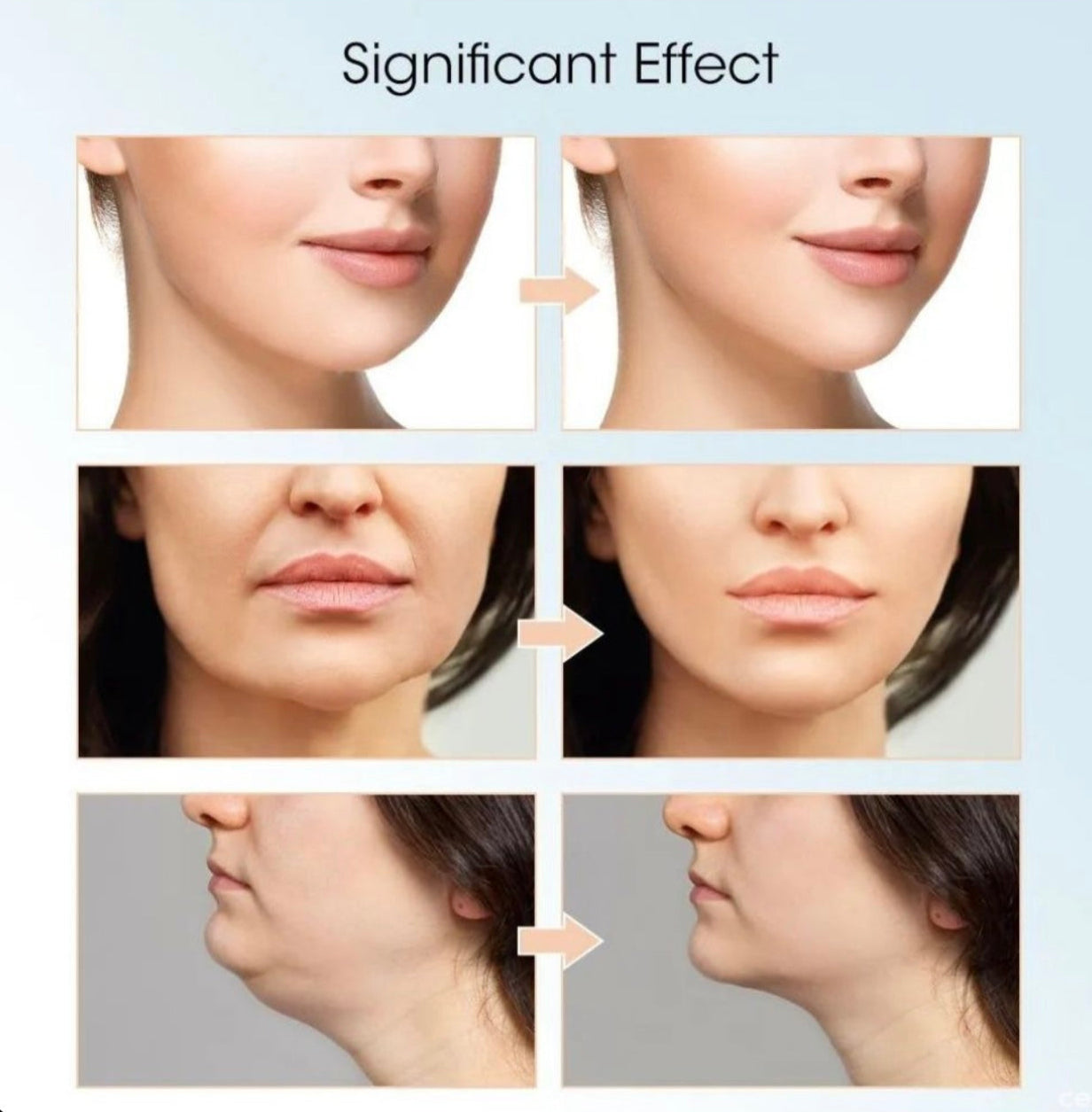 Facial Slimming Device