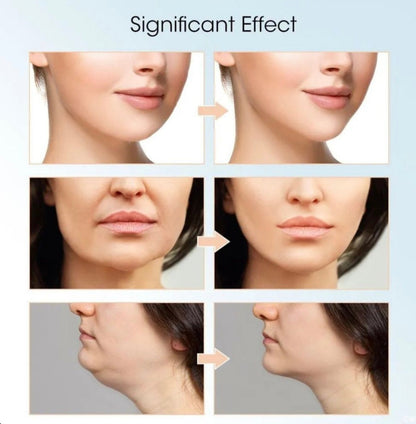 Facial Slimming Device