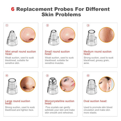 PoreMaster LED Blackhead Vacuum
