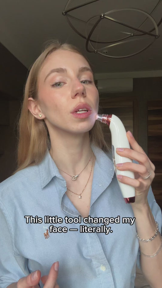 PoreMaster LED Blackhead Vacuum